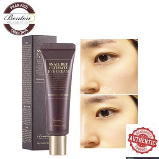 Kem Dưỡng Mắt Phục Hồi Đôi Mắt Mệt Mỏi Benton Snail Bee Ultimate Eye Cream 30g