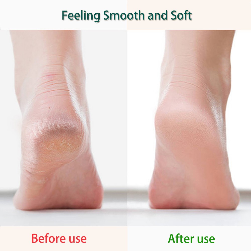 Set 8/10 dụng cụ chăm sóc móng chân chuyên nghiệp gồm dụng cụ chà gót chân chăm sóc móng dũa đa năng