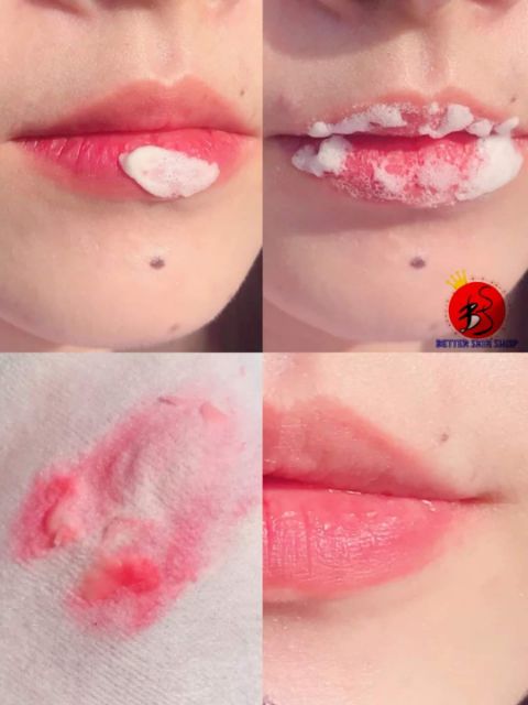 Tẩy da chết môi Unpa Bubi Bubi Bubble Lip Scrub Hàn Quốc