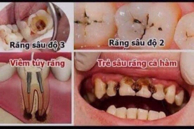 Thuốc Sâu Răng An Khánh Tâm