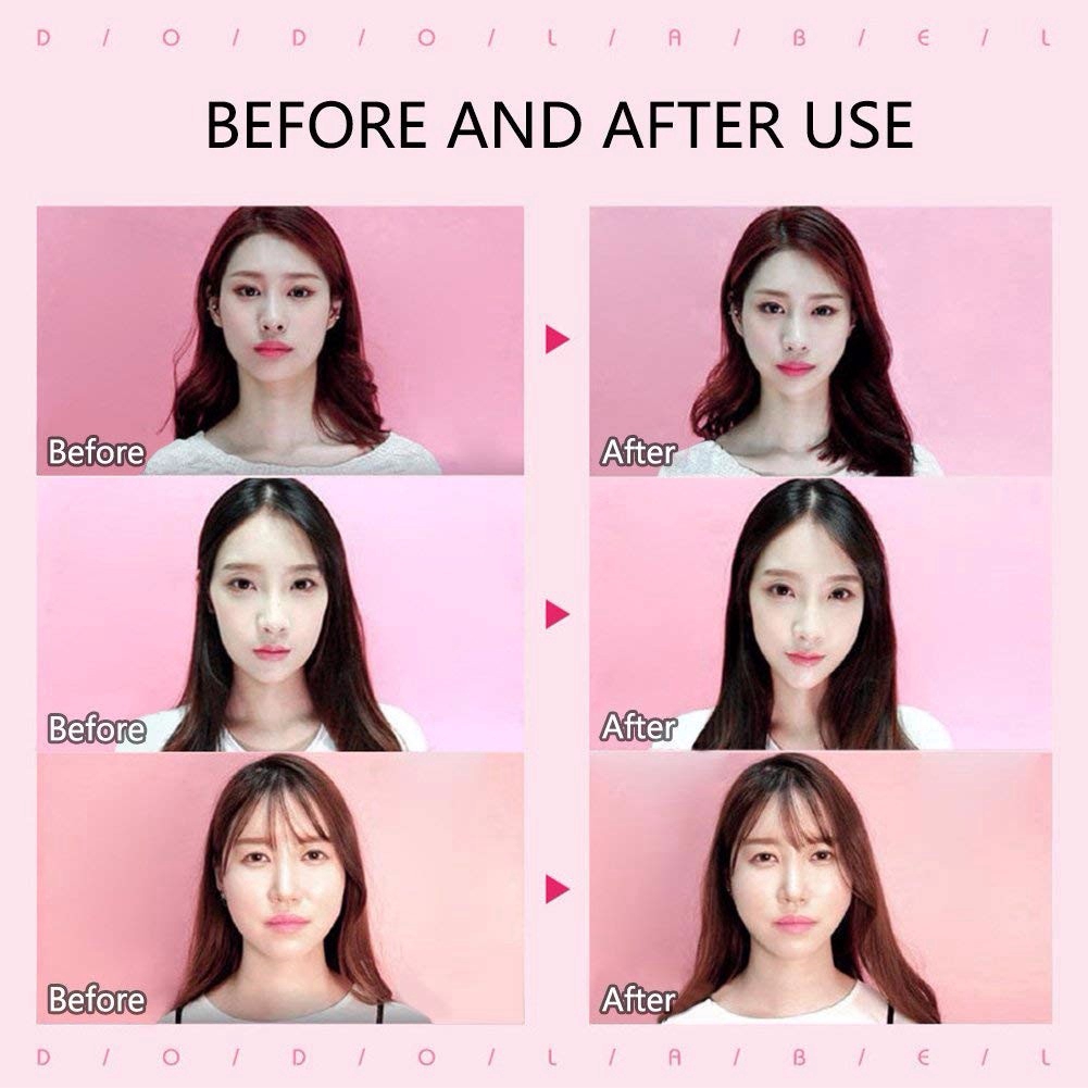 Set 40 băng keo dán nâng cơ mặt tạo cằm V line nhanh chóng hiệu quả