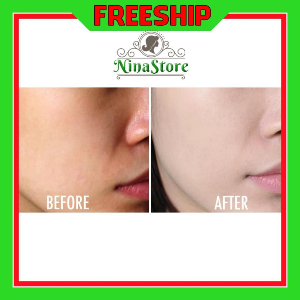 Sữa Rửa Mặt Dạng Gel Simple Kind To Skin Refreshing Facial Wash- NinaStore | BigBuy360 - bigbuy360.vn