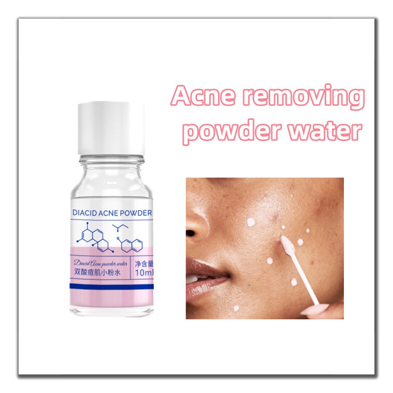 Toner Calamine Acid Lactose Acid Hỗ Trợ Giảm Mụn Chăm Sóc Da
