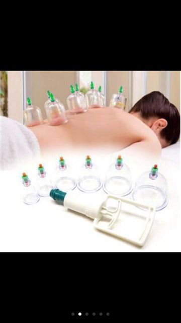 BỘ GIÁC HƠI HÚT CHÂN KHÔNG  HÀNG LOẠI 1