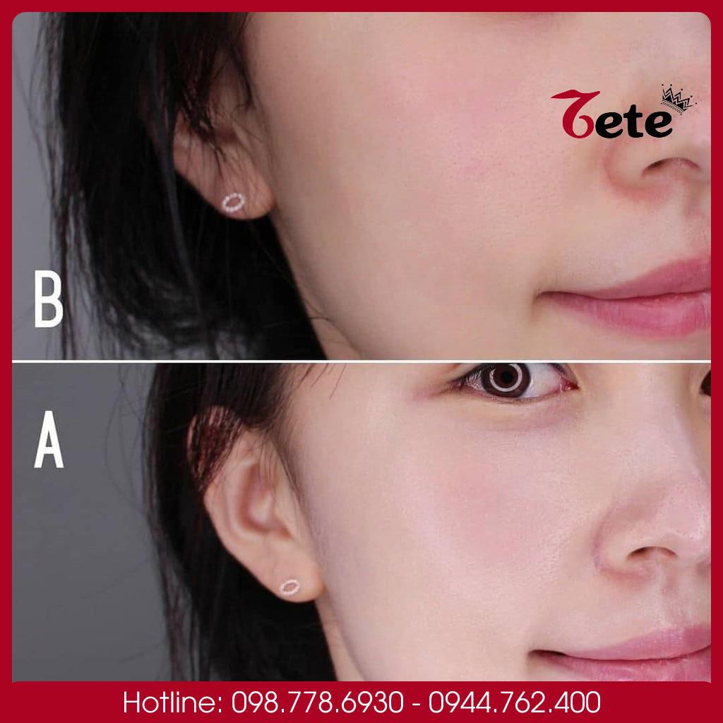 Dưỡng trắng hồng, Serum Cellapy Pink Tone Up Ampoule SPF50+ PA++++ | BigBuy360 - bigbuy360.vn