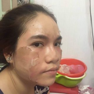 bộ mỹ phẩm thay da face tca usa