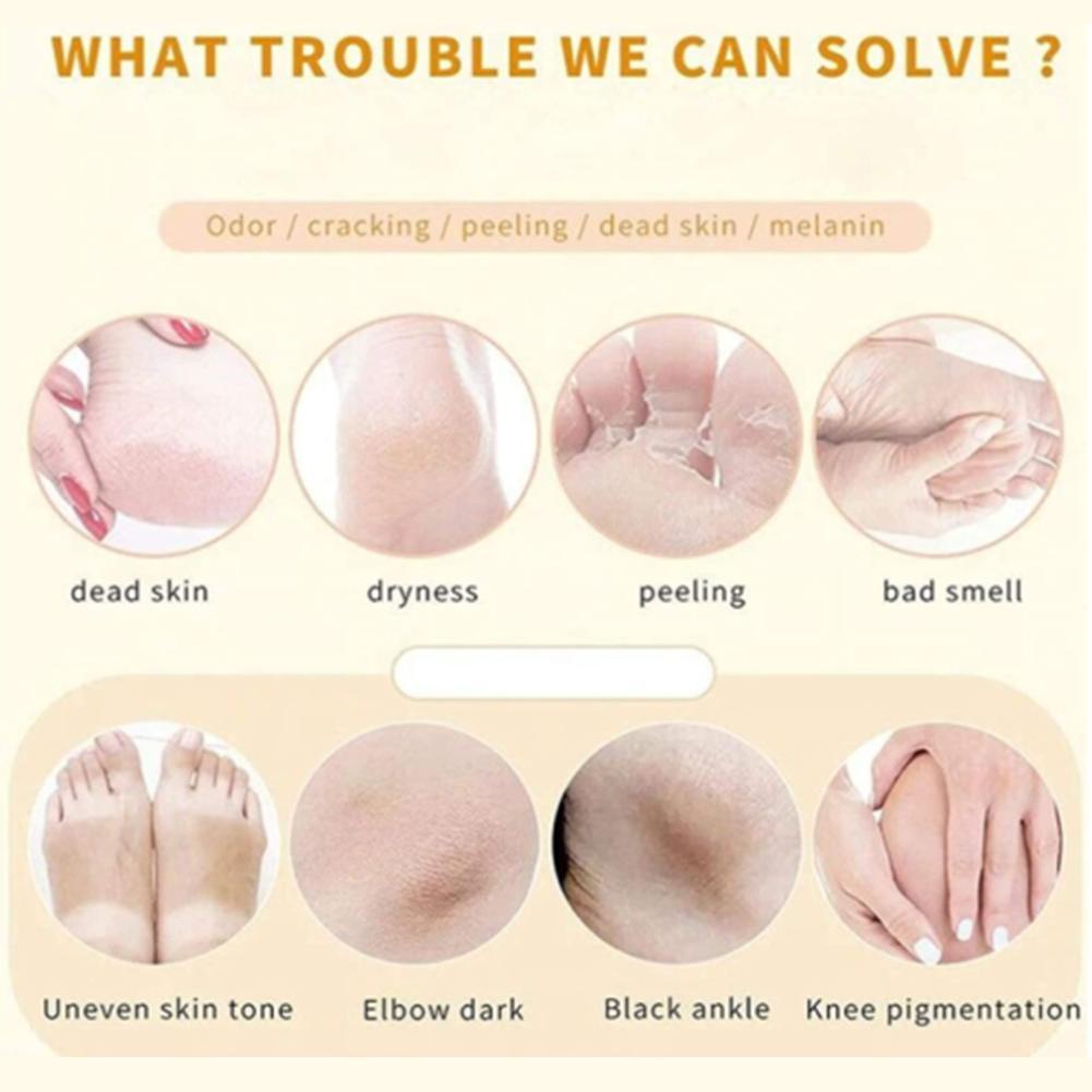 Chai Xịt Loại Bỏ Tế Bào Chết Chăm Sóc Da Chân