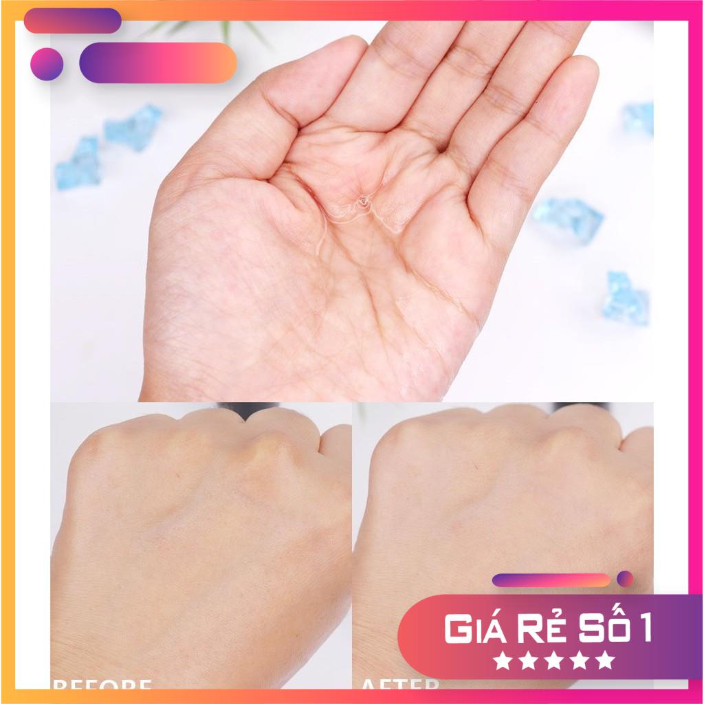 31[CHINH HANG] - Nước Hoa Hồng SOME BY MI Cho Da Mụn Miracle Toner AHA- BHA-PHA 30 Days 150ml | BigBuy360 - bigbuy360.vn
