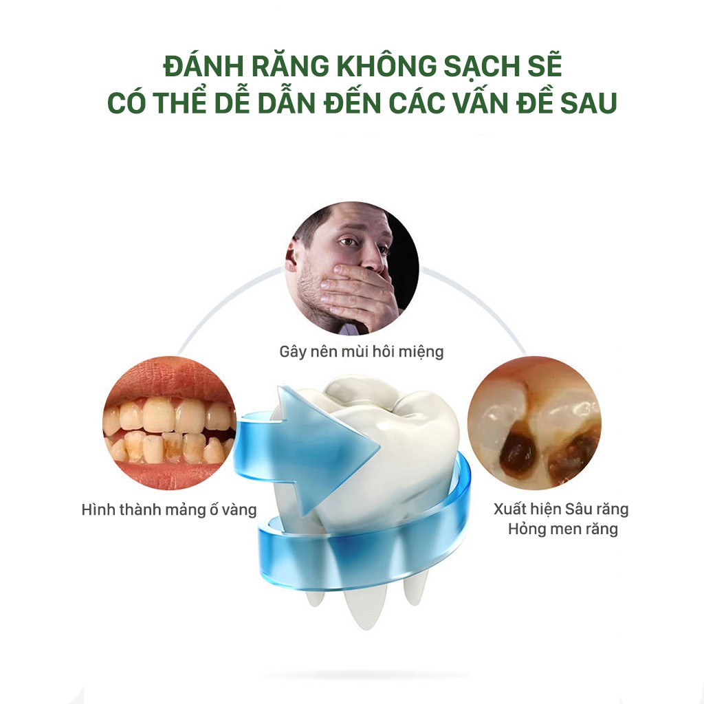 Bàn Chải Điện Chữ U Sonic (massage giúp giảm viêm lợi tụt lợi và bệnh nha chu)