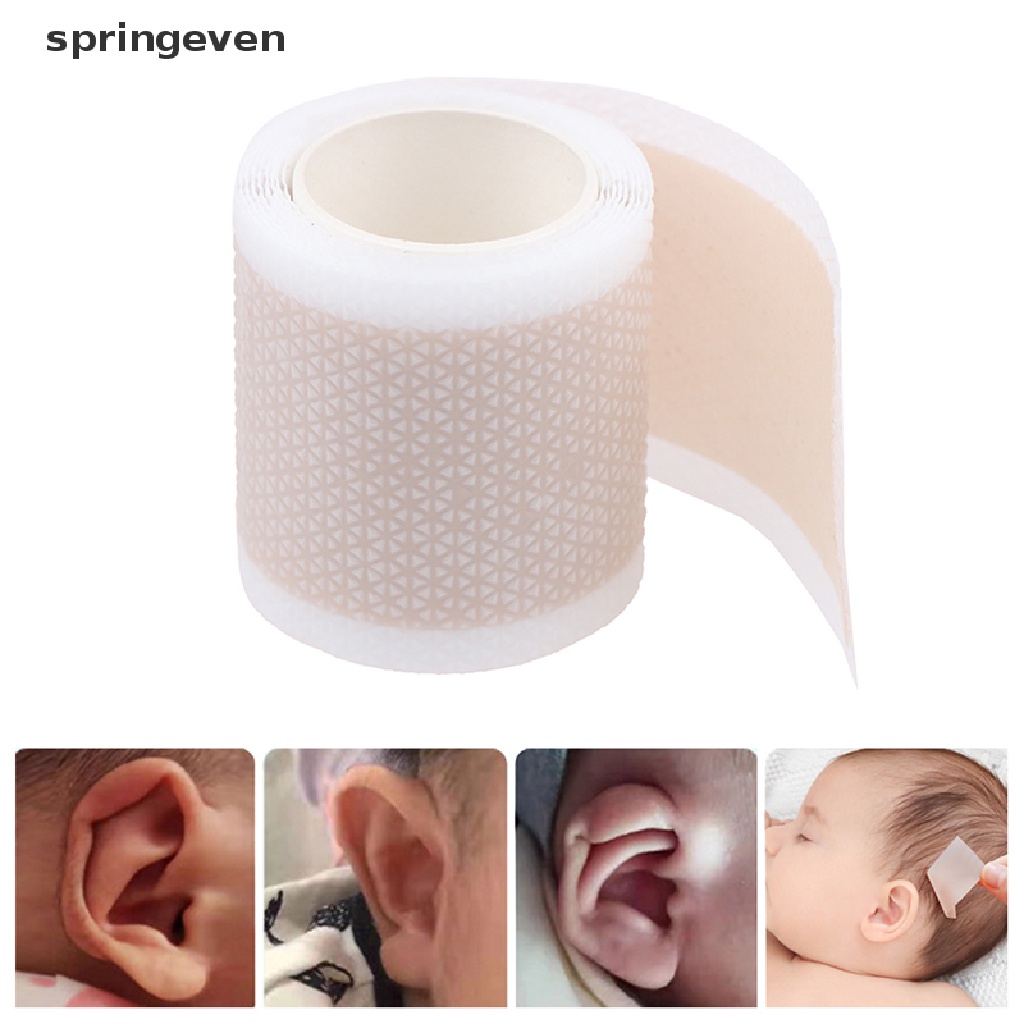 Miếng Dán Điều Chỉnh Tư Thế Tai Cho Bé Sơ Sinh 4 * 50cm