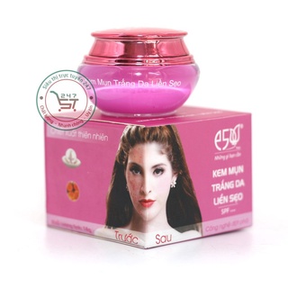 Kem Mụn Trắng da Liền sẹo Dưỡng ẩm Mịn da Che khuyết điểm 12g E5 (Tím)