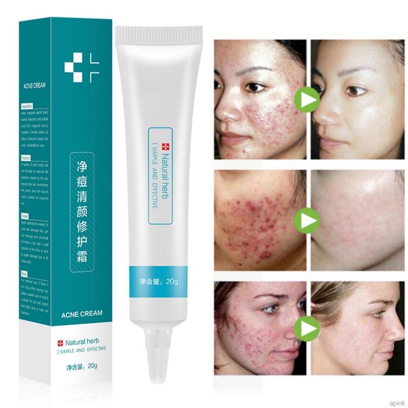 [Hàng mới về] Kem Giảm Mụn Dưỡng Ẩm Thu Nhỏ Lỗ Chân Lông Làm Săn Chắc Da 20g