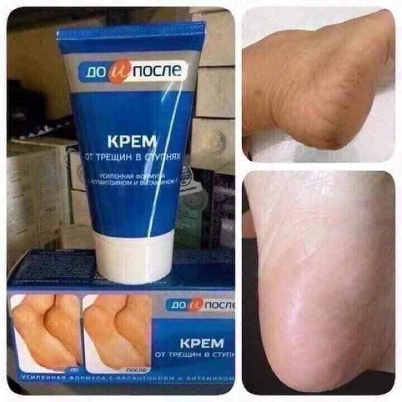 Kem Giảm Nứt Gót Chân Kpem Apteka Nga Chính Hãng 50ml