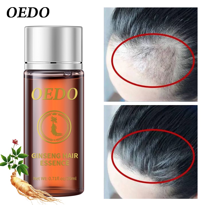 Set 2 serum tinh chất nhân sâm OEDO kích thích tóc mọc dày phục hồi chân tóc mạnh mẽ nhanh chóng
