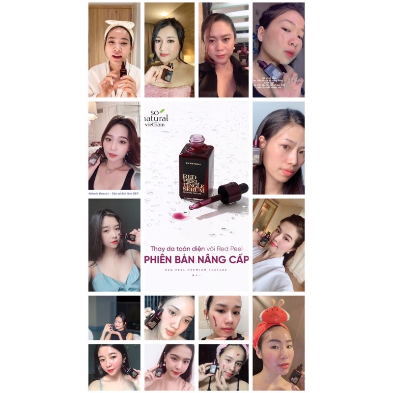 Thay da sinh học Và Tẩy Tế Bào Chết Red Peel Tingle Serum Tinh Chất  Tái Tạo Làn Da So Natural Nhập Khẩu  Hàn Quốc