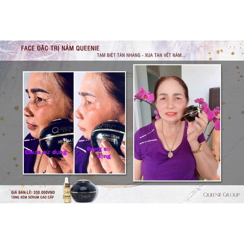 KEM DƯỠNG DA MẶT NGĂN NGỪA NÁM TÀN NHANG CỦA QUEENIE SKIN