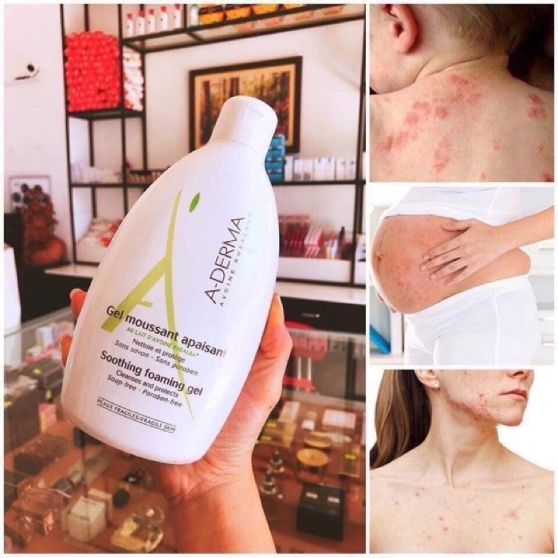 SỮA TẮM GIẢM MỤN LƯNG, VIÊM LCL ADERMA 500ml