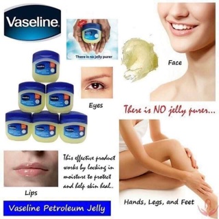 Kem nẻ Vaseline 49g