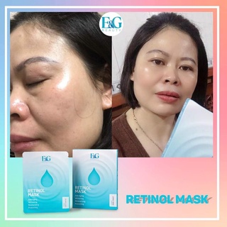 Mặt Nạ Retinol - E&G Beauty