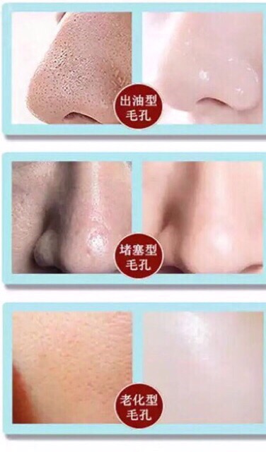 Tinh chất dưỡng shrinkage pore 30ml G204 | BigBuy360 - bigbuy360.vn