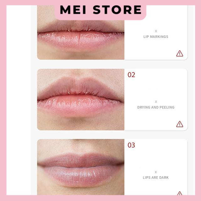 Hộp 20 Miếng Mặt Nạ Môi Bioaqua Của VenZen Dưỡng Ẩm Bổ Sung Collagen