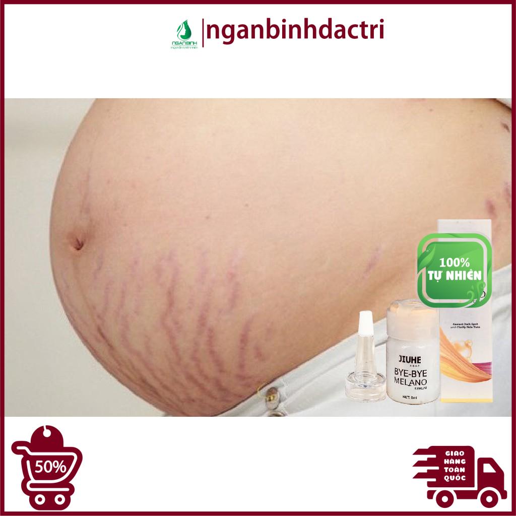 Serum tri thâm hàn quốc JIUHE Q-PEARL giảm thâm do mụn khửu tay chân, thâm sẹo, thâm nách hiệu quả