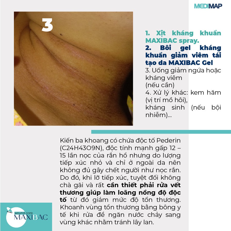 Gel Maxibac nhanh lành, không xót cho da bị tổn thương 25g