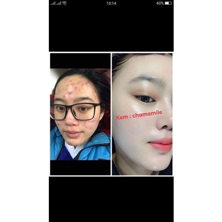 Kem tái tạo Chamomile hồng sâm