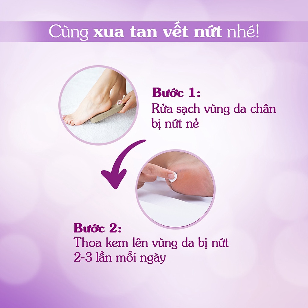 Kem Nứt Gót Oriss Soft And Heal 30G