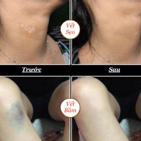 Kem che xăm che khuyết điểm tạm thời Tattoo chính hãng chống nước hiệu quả, che hoàn toàn hình xăm đậm màu | BigBuy360 - bigbuy360.vn