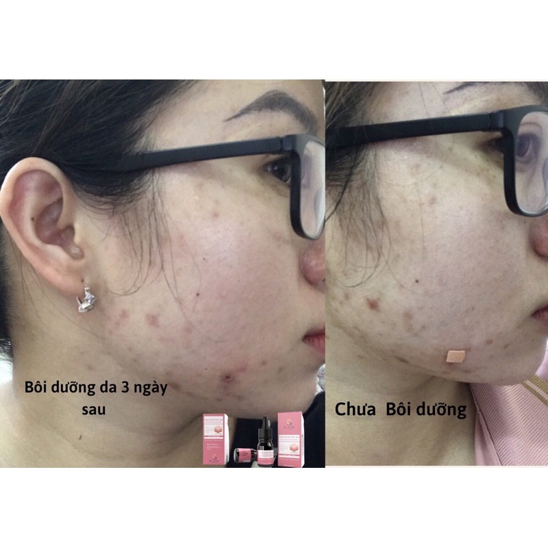 Serum dưỡng trắng mờ thâm nám Black Diamod | BigBuy360 - bigbuy360.vn