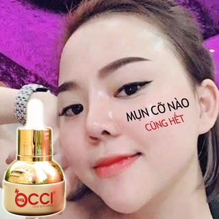 Serum Mụn Bio-Occi (25ml)