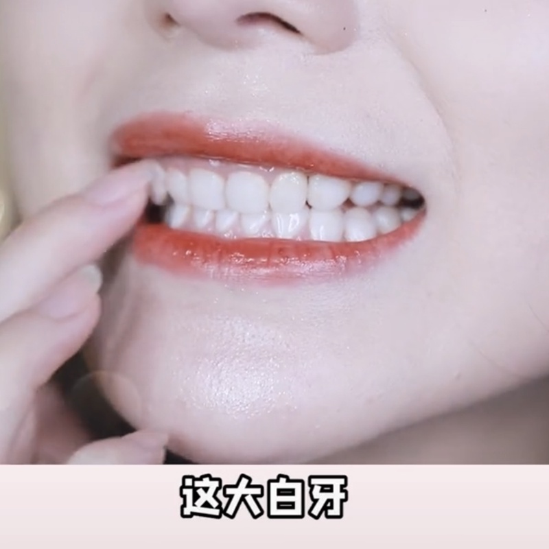 ◄♛Miếng dán trắng răng 5D Tạo tác Răng vàng Hyun Răng trắng