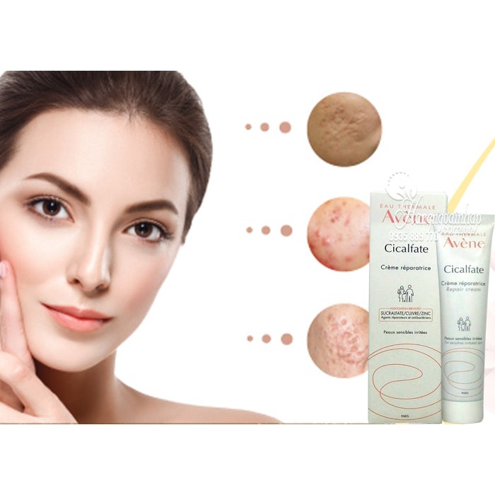 KEM AVENE CICALFATE - KEM PHỤC HỒI DA - LIỀN SẸO - GIẢM THÂM 40ml