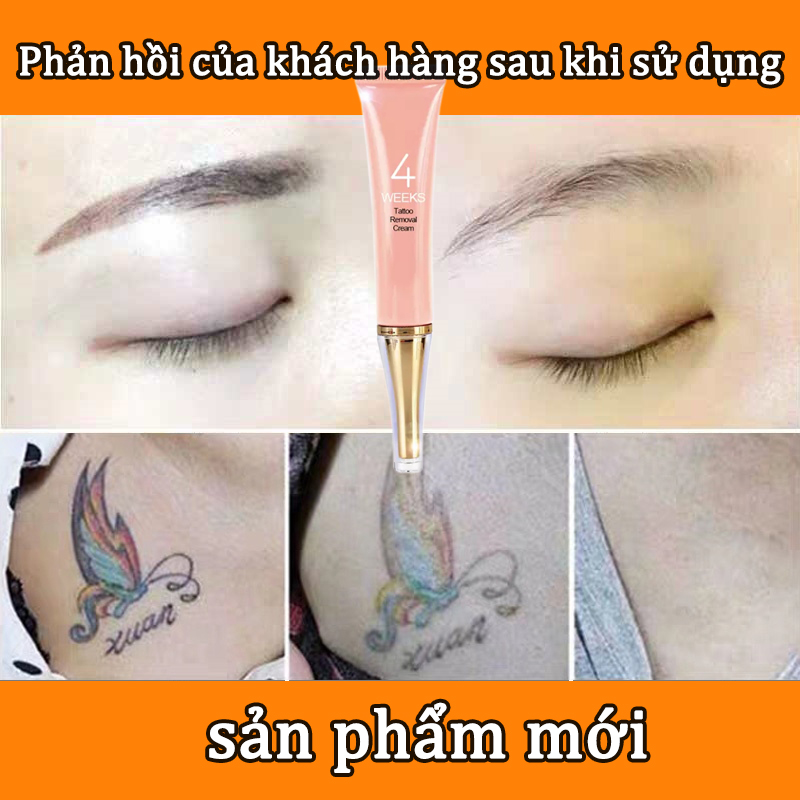 Kem Xóa Hình Xăm Vĩnh Viễn, Không Đau, Có Hiệu Quả Tối Đa