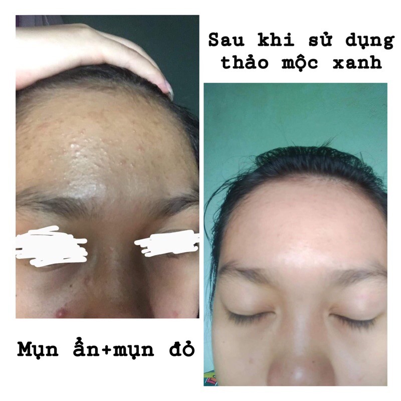 Thảo mộc xanh🔥 freeship 🔥 | BigBuy360 - bigbuy360.vn