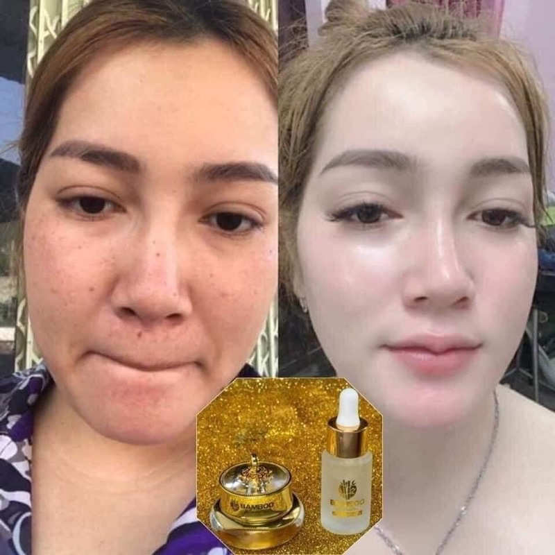 Combo kem face lụa bamboo+serum tái sinh da Mẫu mới 8- 2023