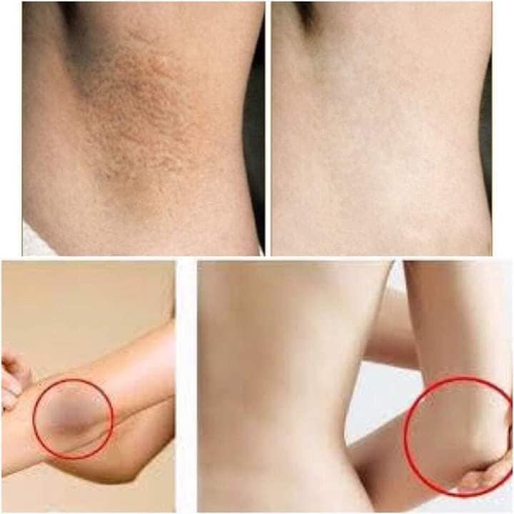 Kem Mờ thâm nách Vacosi Whitening