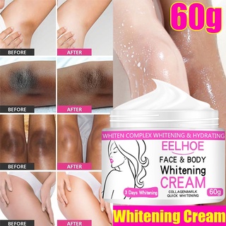 Kem dưỡng trắng vùng da dưới cánh tay/khuỷu tay/vùng kín hiệu quả cao cấp