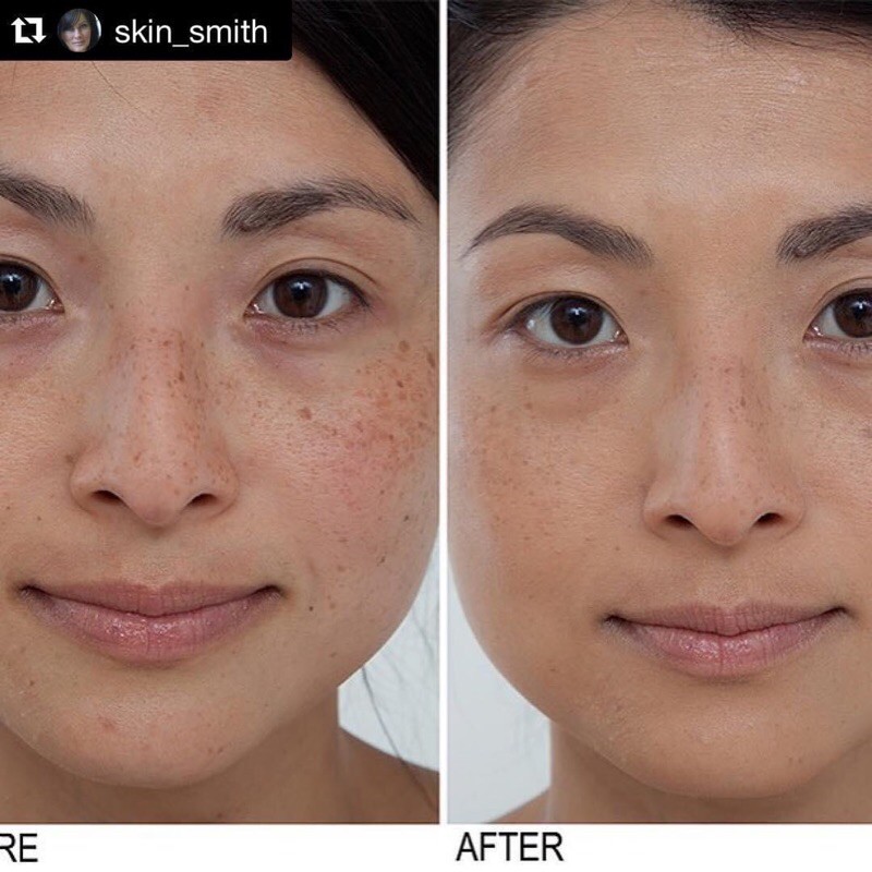 Xịt khoáng chống lão hoá Is Clinical Copper Firming Mist - Chính hãng | BigBuy360 - bigbuy360.vn