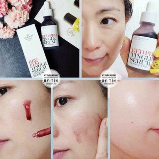 Tinh chất Red Peel Tinglee Serum