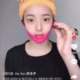 Tạo hình Vline ko cần phẫu thuật