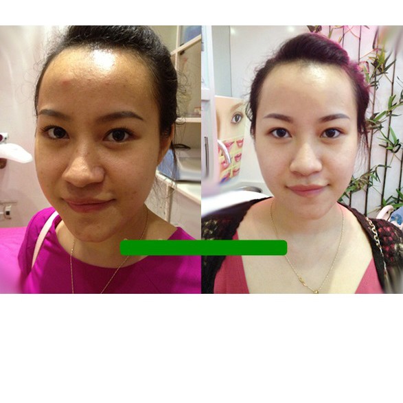 [ HÀNG CHÍNH HÃNG] Viên Uống Trắng Da Sương Mai Học Viện Quân Y Việt Nam (60 Viên/ Hộp). | BigBuy360 - bigbuy360.vn