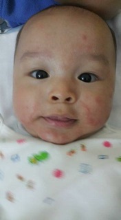 Kem nẻ Dexeryl Pháp