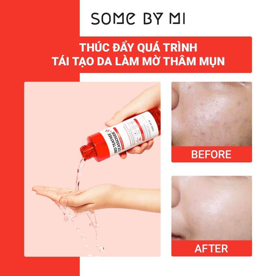 Nước Hoa Hồng Giảm Mụn Cho Da Nhạy Cảm Some ByM Red Teatree Cicassoside Final Solution 150ml