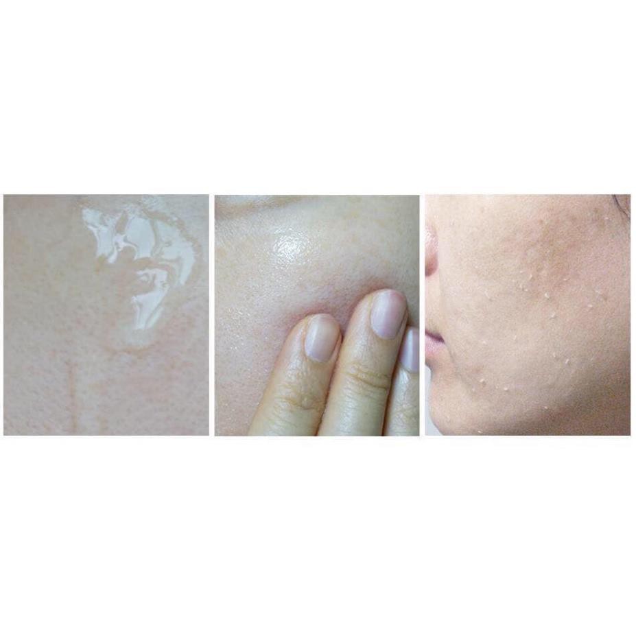 (MiNi) Gel tẩy tế bào da chết Botanical Natural Peeling Gel dùng thiên cho da dầu nội địa Nhật Bản