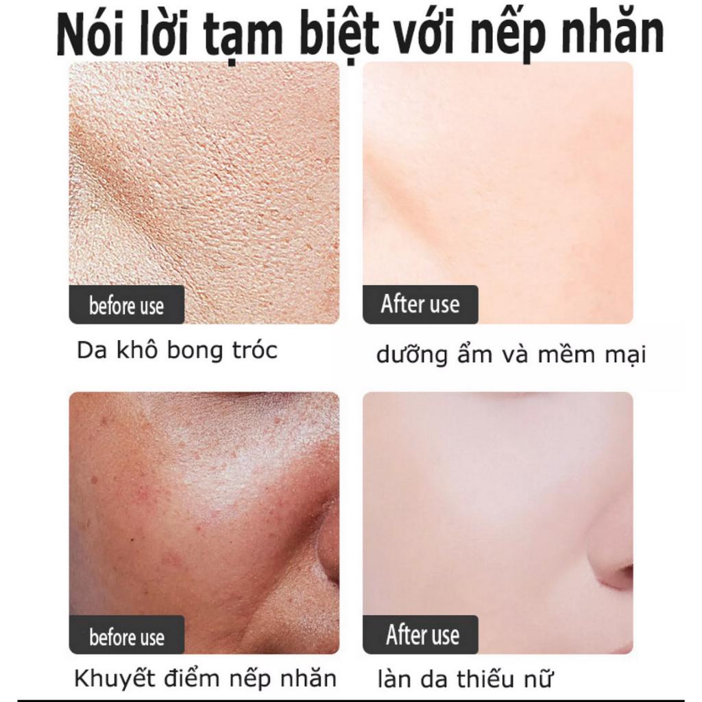 Serum dưỡng trắng Serum chống lão hóa Serum căng bóng da mặt 30ml slàm mờ nếp nhăn,ngăn ngừa lão hóa da, phục hồi độ đàn hồi của da, Giữ ẩm cho làn da mịn màng và trắng sáng