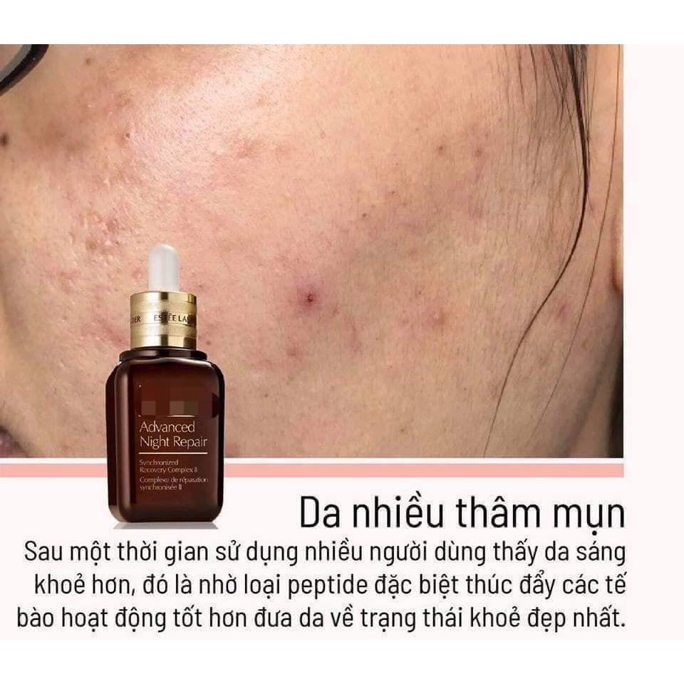 SERUM NÂU ESTEE LAUDER ARN FULLSIZE 100ml phục hồi da cực đỉnh