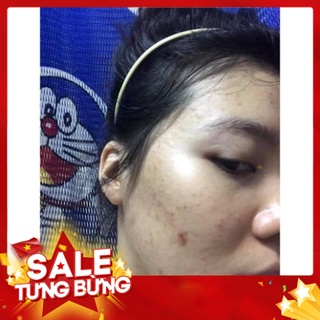 Combo tri mun Dr mai [CHÍNH HÃNG] ✅