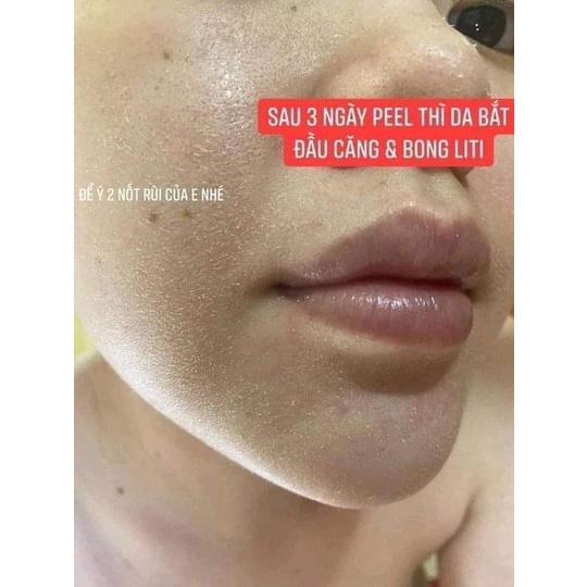 Peel da thay da sinh học tẩy tế bào chết giảm thâm sạm dùng cho mặt lưng nách vi tảo thảo mộc LUXI SKIN Sample 5ml